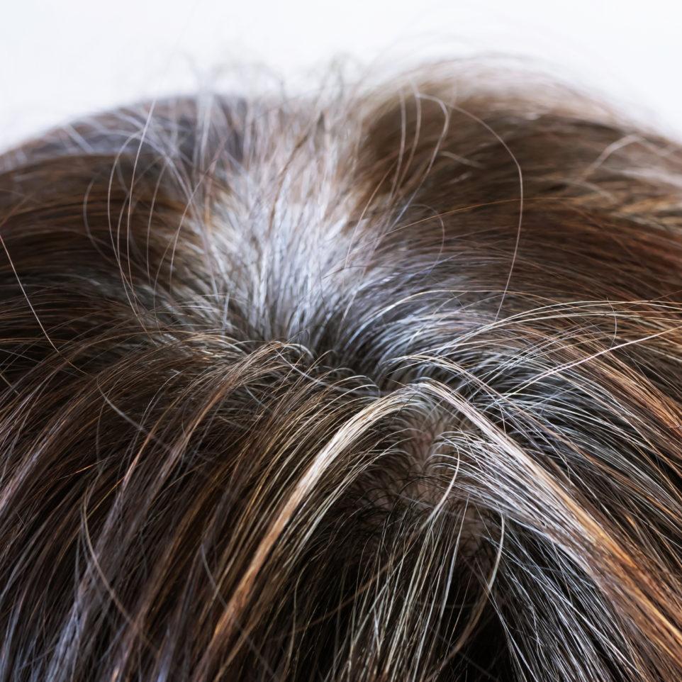 what-causes-gray-hair